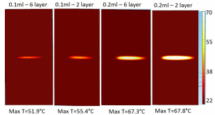 Remote Monitoring of Structures in Composite Materials via Embedded Thermo ...
