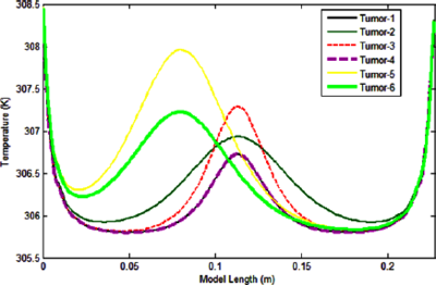 Numerical Simulation and Thermal Analysis of Tumor in the Human Body