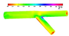 Non-Newtonian Hemodynamics and Shear Stress Distribution in Three ...