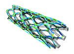 Blood Vessel Stent Deformation